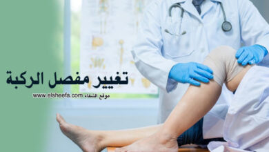 افضل دكتور تغيير مفصل الركبة في الرياض