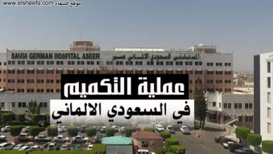 عملية التكميم في مستشفى السعودي الالماني عسير