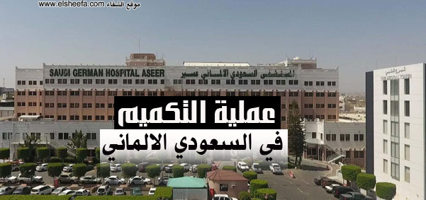عملية التكميم في مستشفى السعودي الالماني عسير